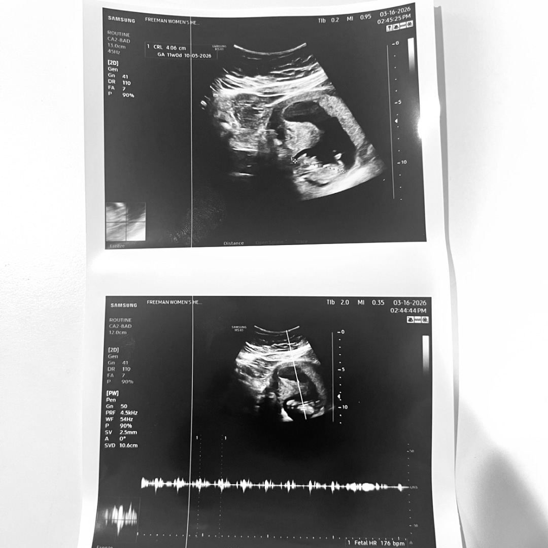 Photo shared by MaKensie for their Babylist baby registry.