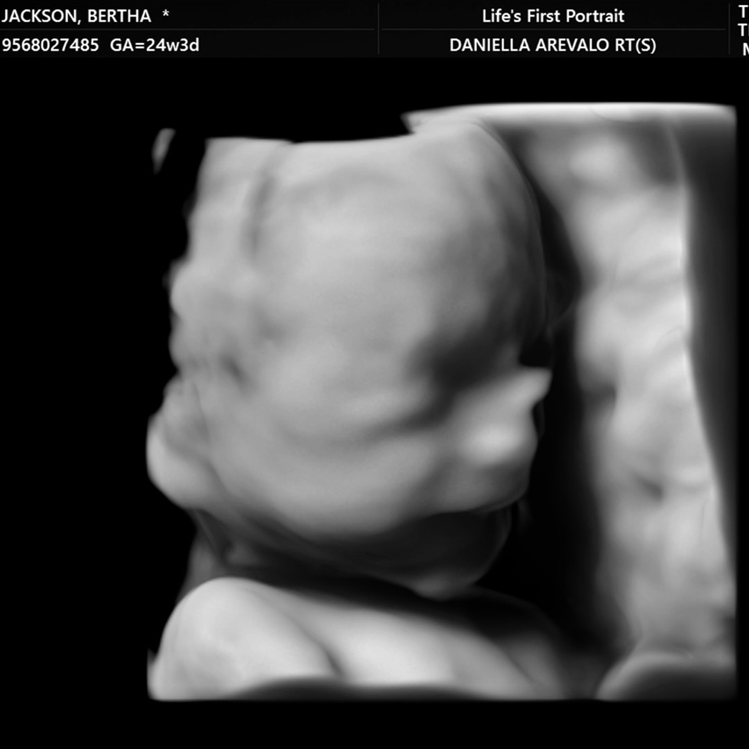 Photo shared by Bertha for their Babylist baby registry.