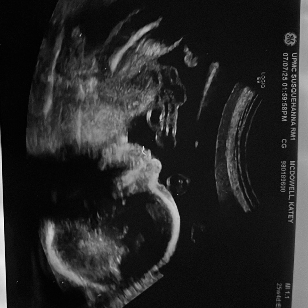 Photo shared by Katey for their Babylist baby registry.