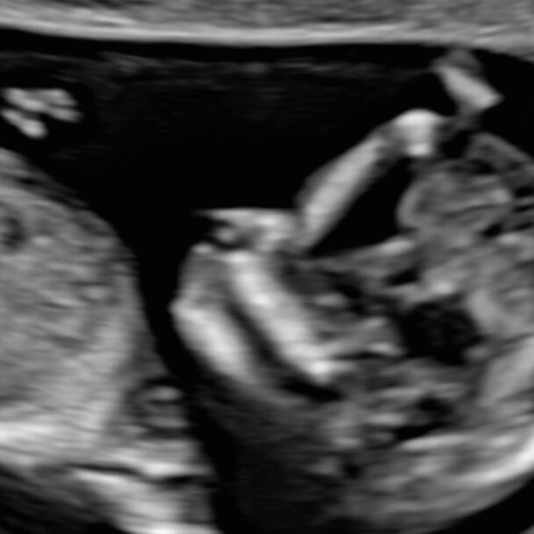 Photo shared by Taylor for their Babylist baby registry.