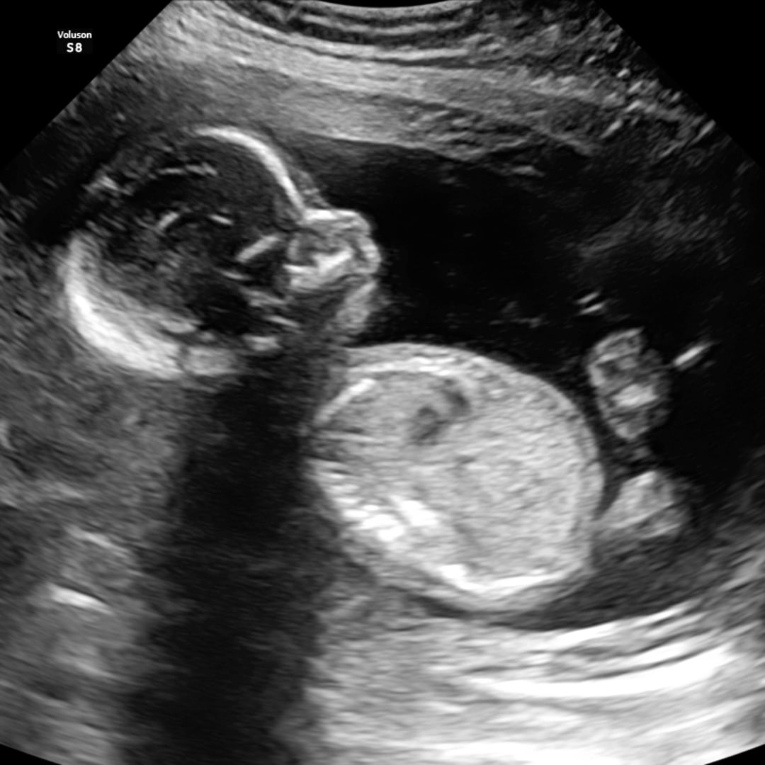 Photo shared by Kylee for their Babylist baby registry.