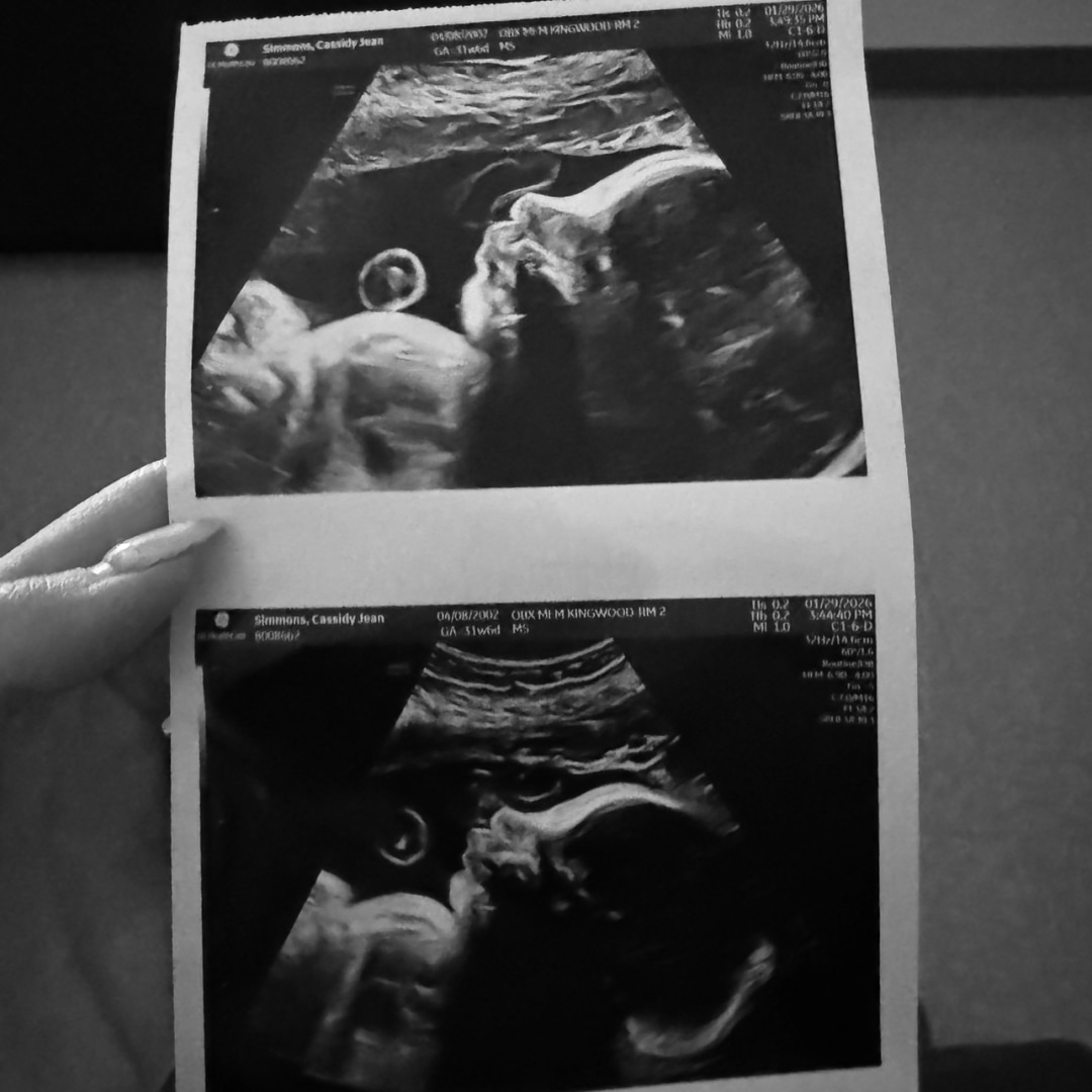 Photo shared by Cassidy for their Babylist baby registry.