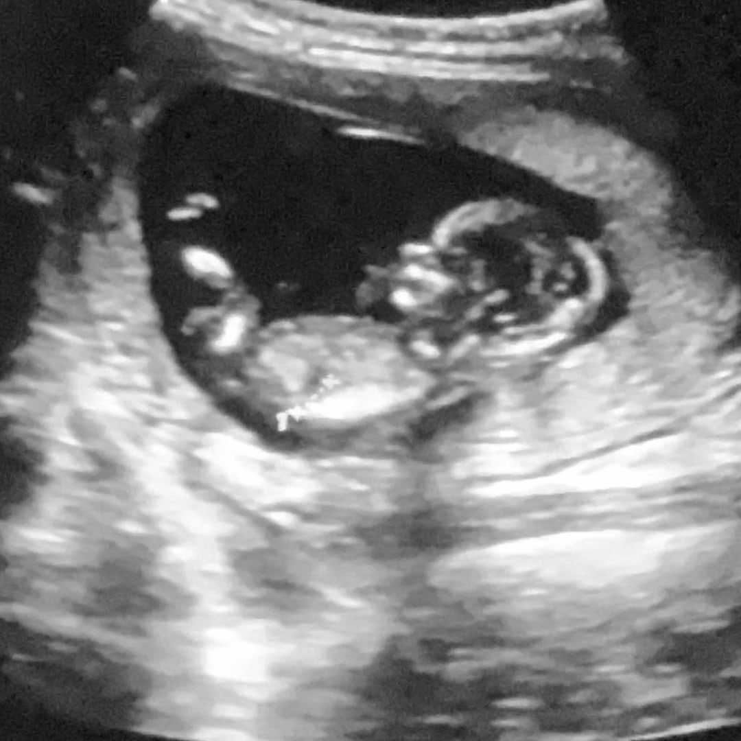 Photo shared by Brionna for their Babylist baby registry.