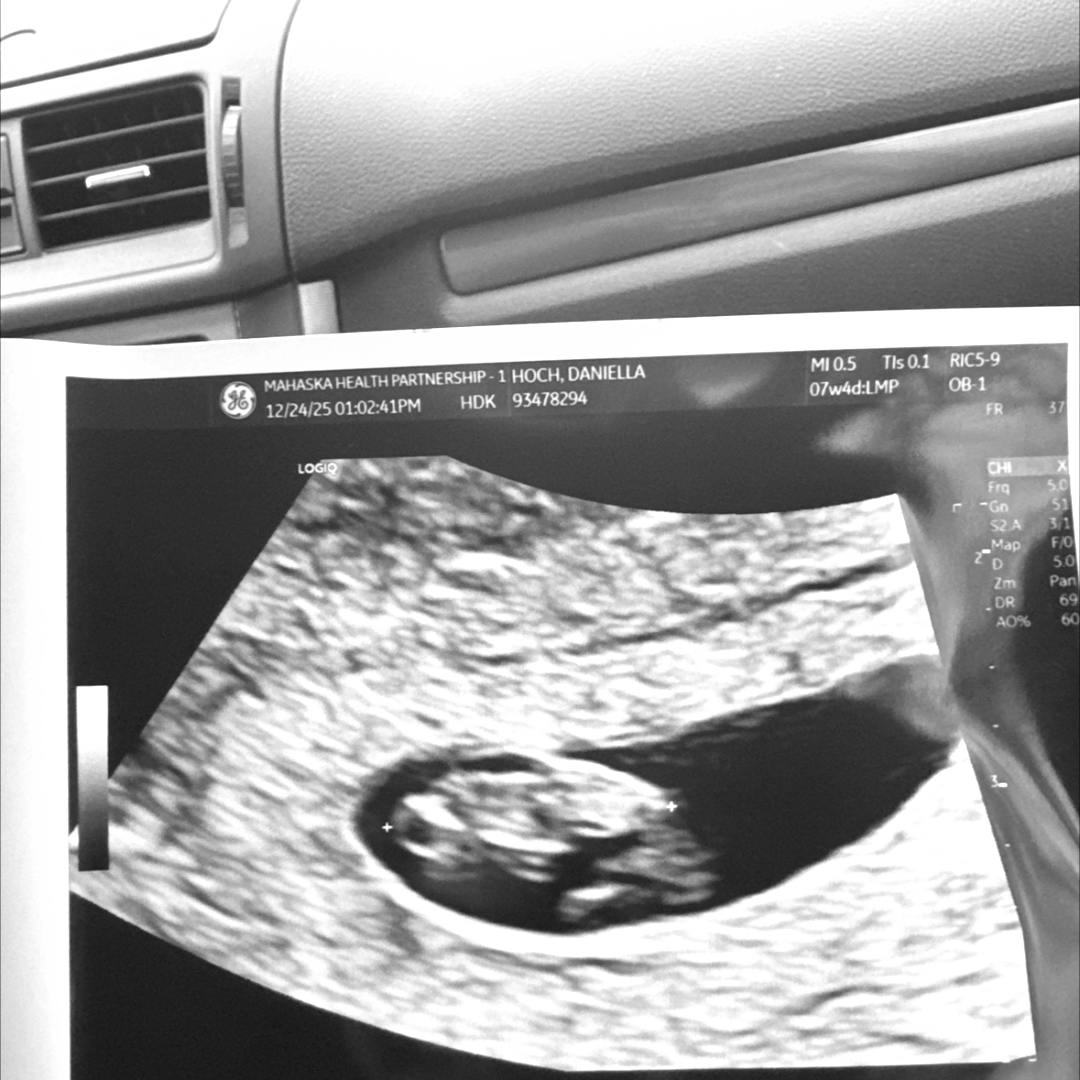 Photo shared by Daniella for their Babylist baby registry.