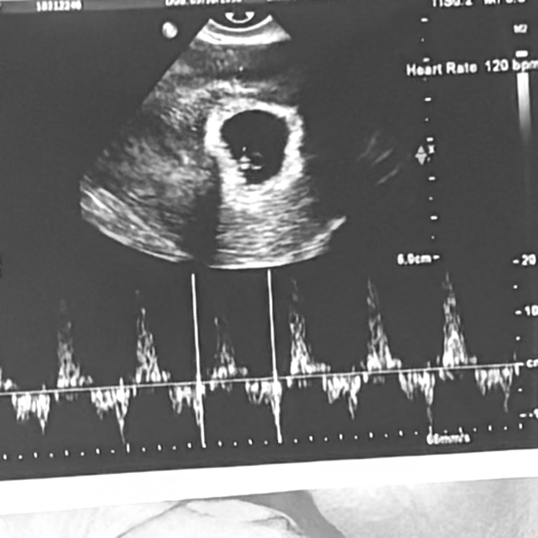 Photo shared by Ashley for their Babylist baby registry.