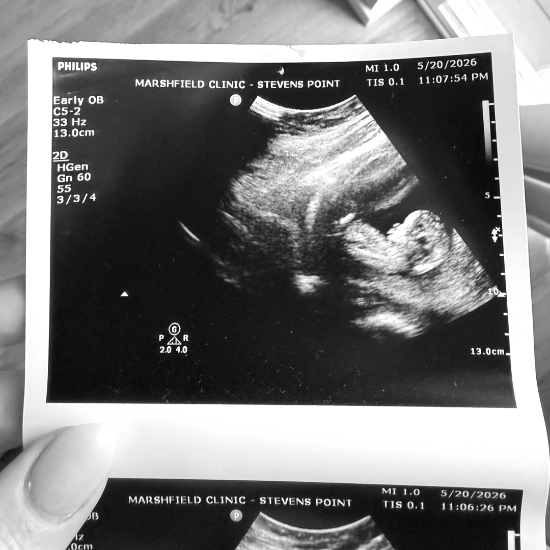 Photo shared by Brooklyn for their Babylist baby registry.