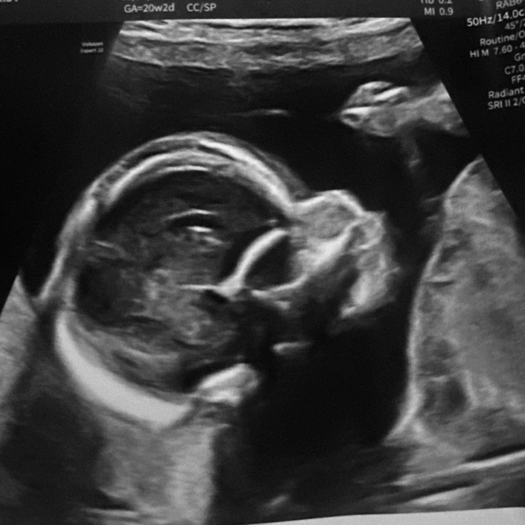 Photo shared by Adamaris for their Babylist baby registry.