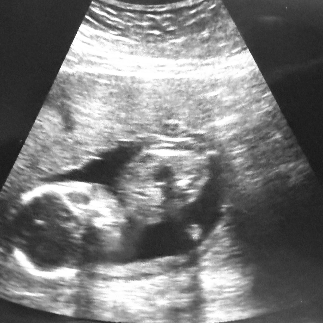 Photo shared by Lauren for their Babylist baby registry.