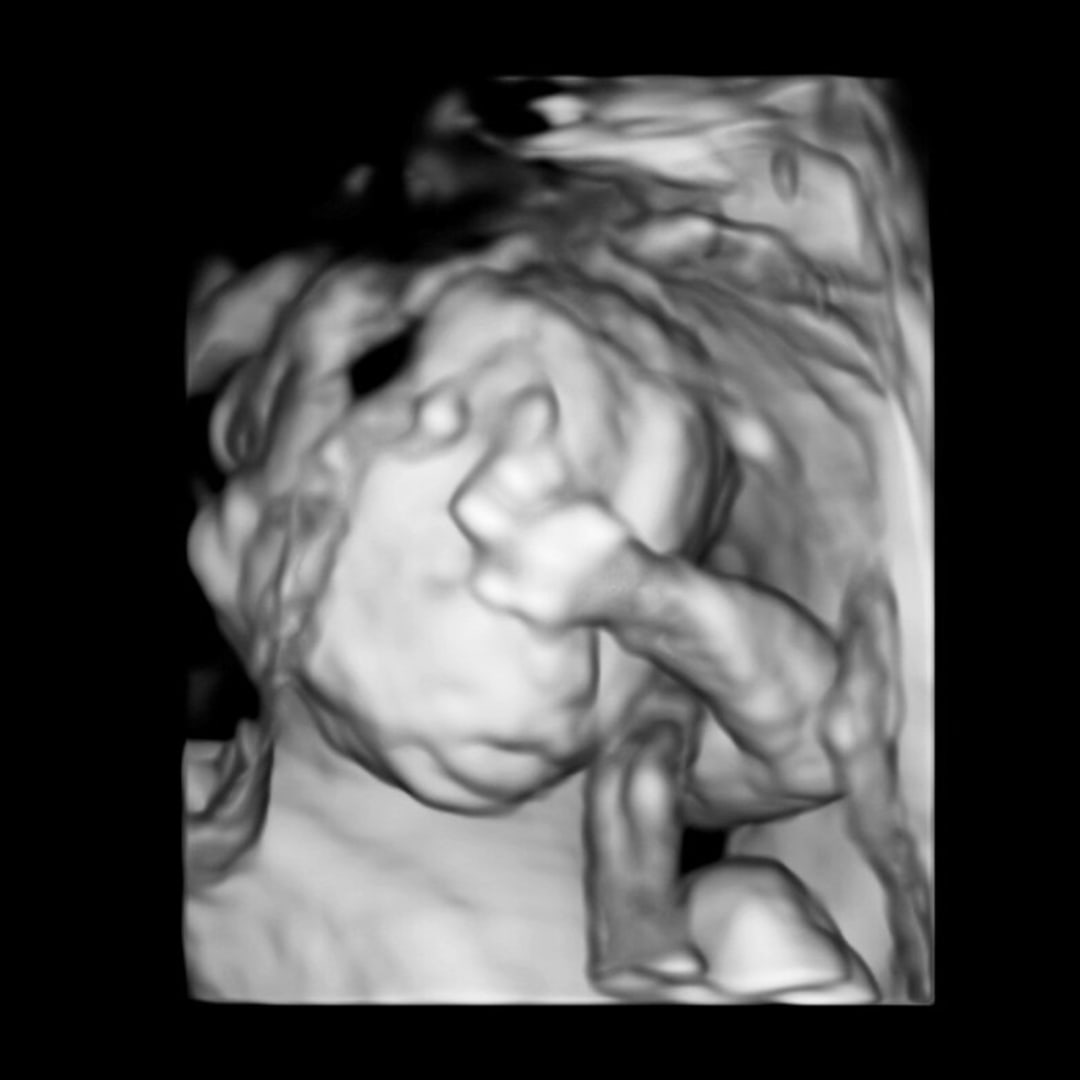 Photo shared by Laci for their Babylist baby registry.