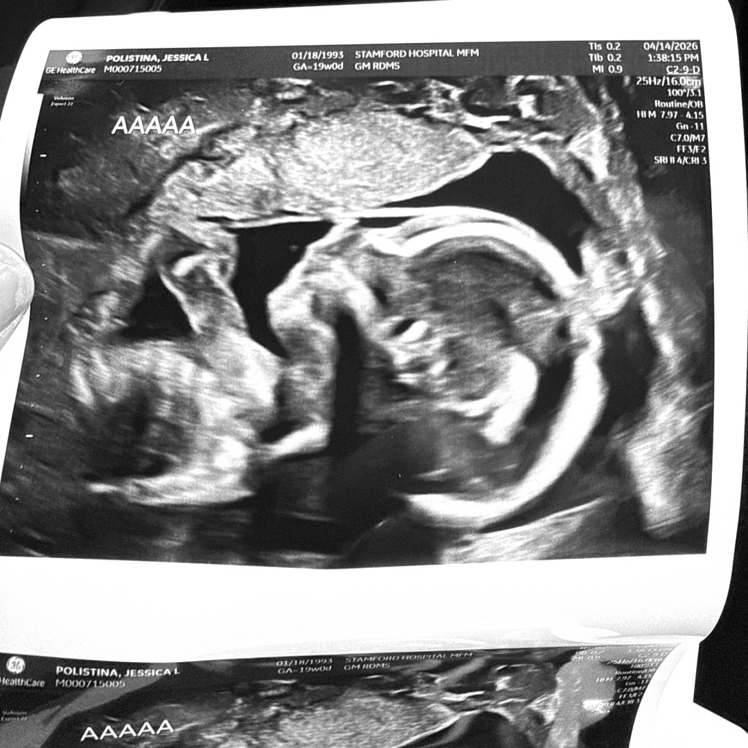 Photo shared by Jessa for their Babylist baby registry.