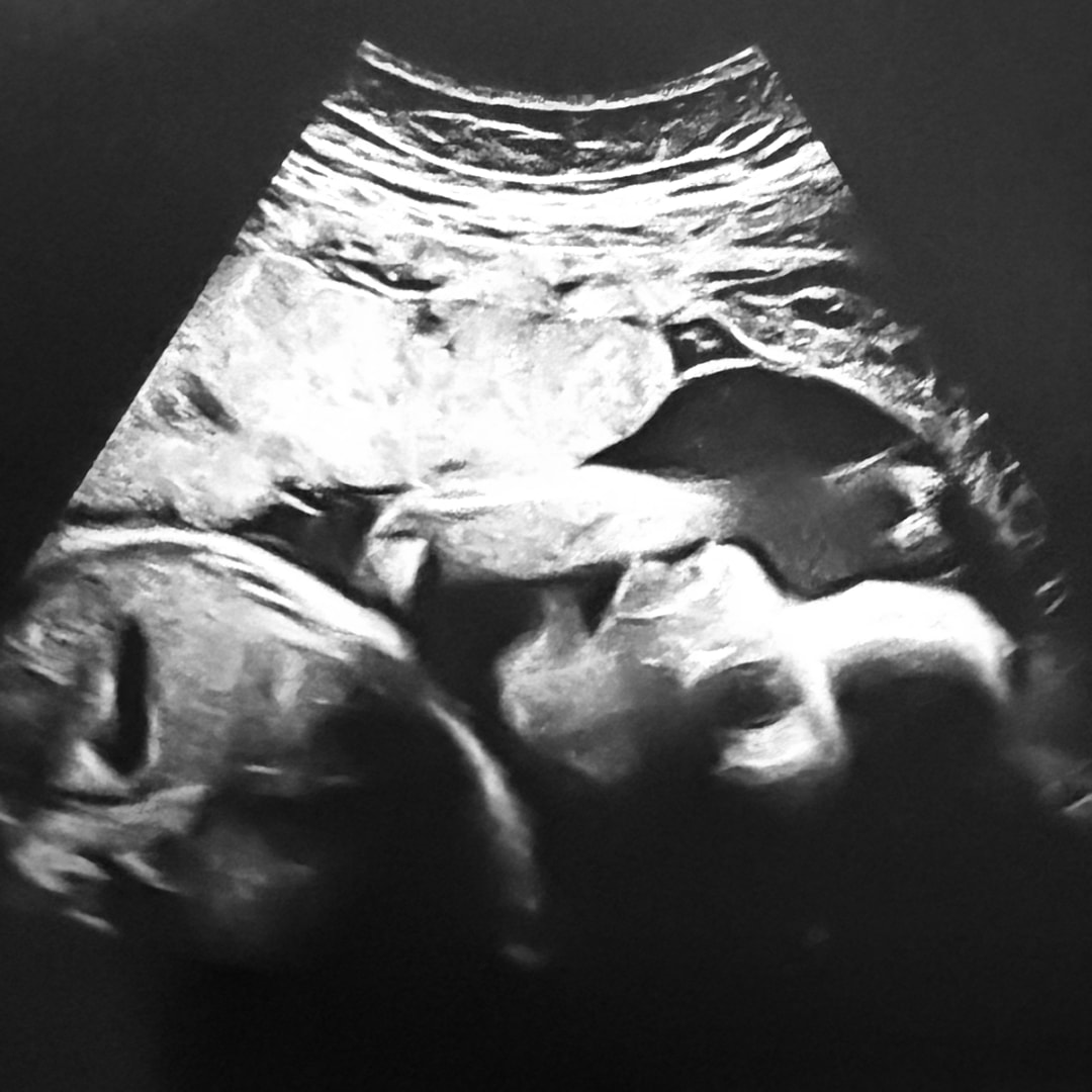 Photo shared by Mandie for their Babylist baby registry.
