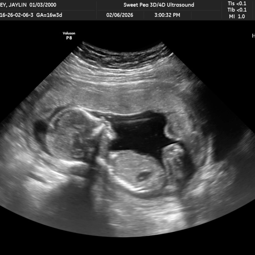 Photo shared by JayLin for their Babylist baby registry.