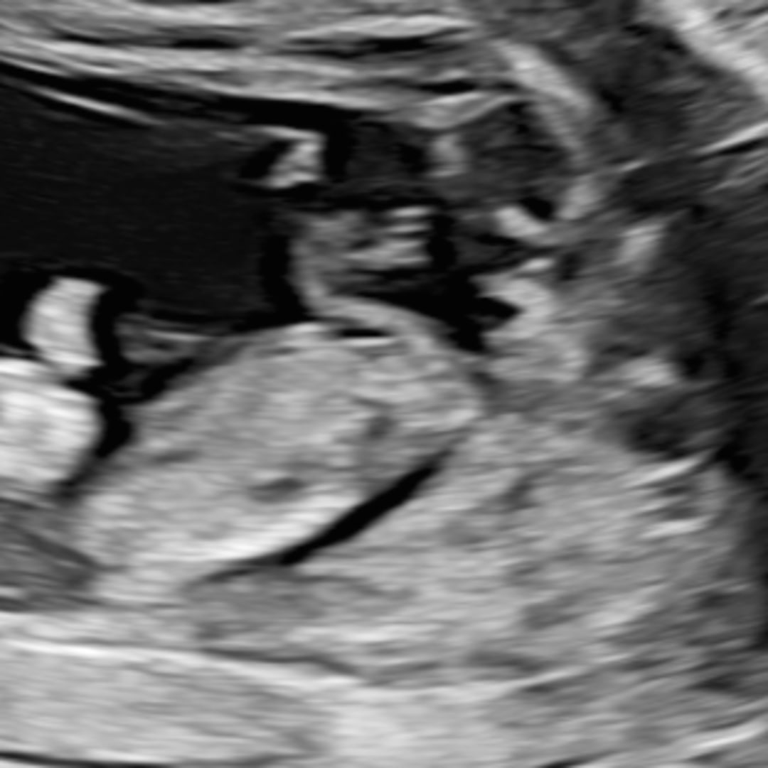 Photo shared by Jessica for their Babylist baby registry.