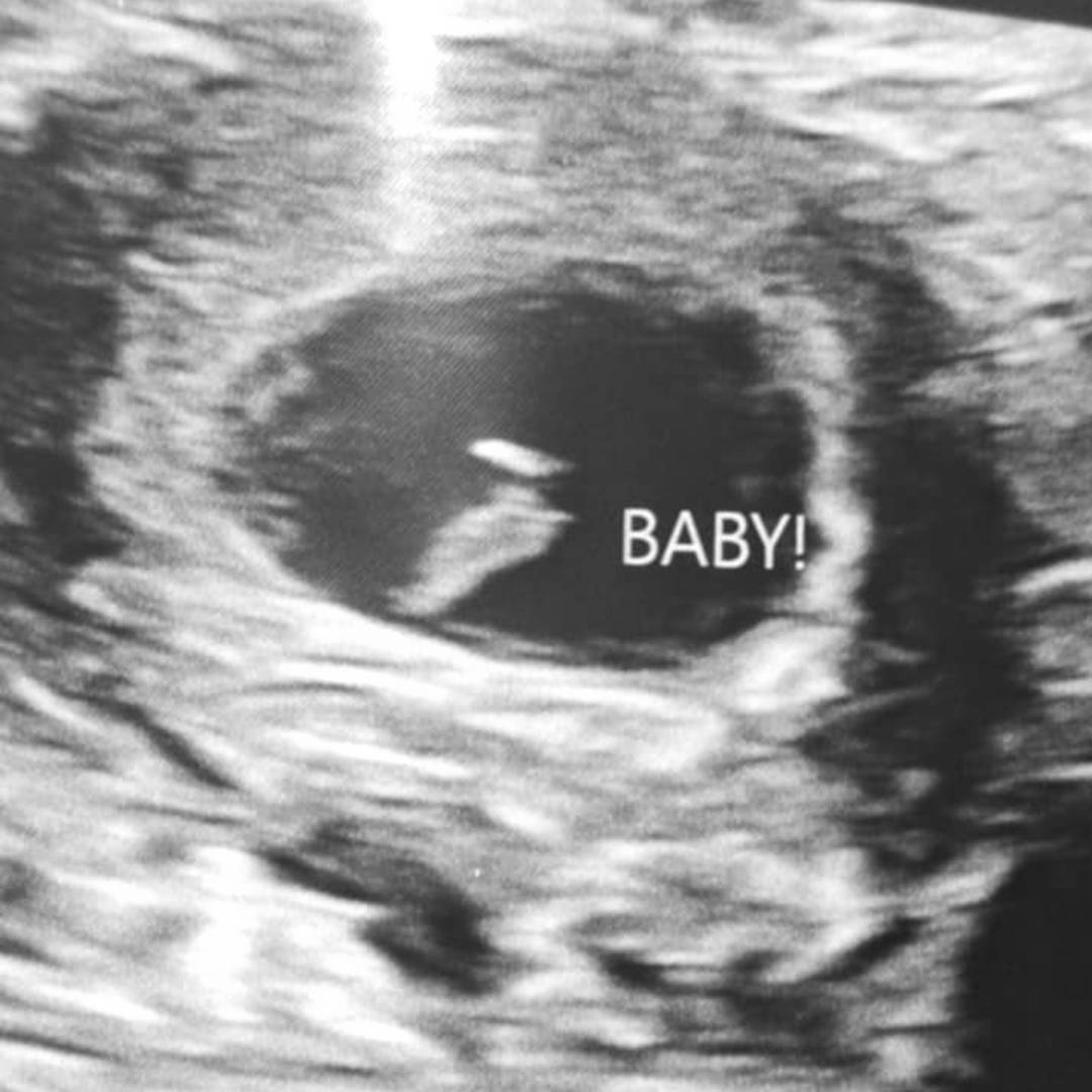 Photo shared by Allyson for their Babylist baby registry.