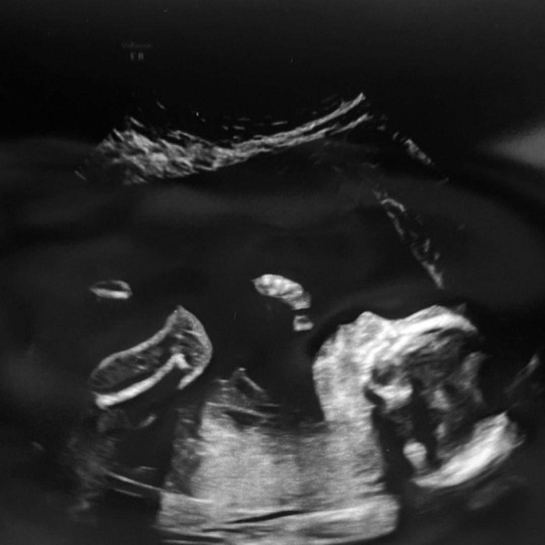 Photo shared by Harley for their Babylist baby registry.