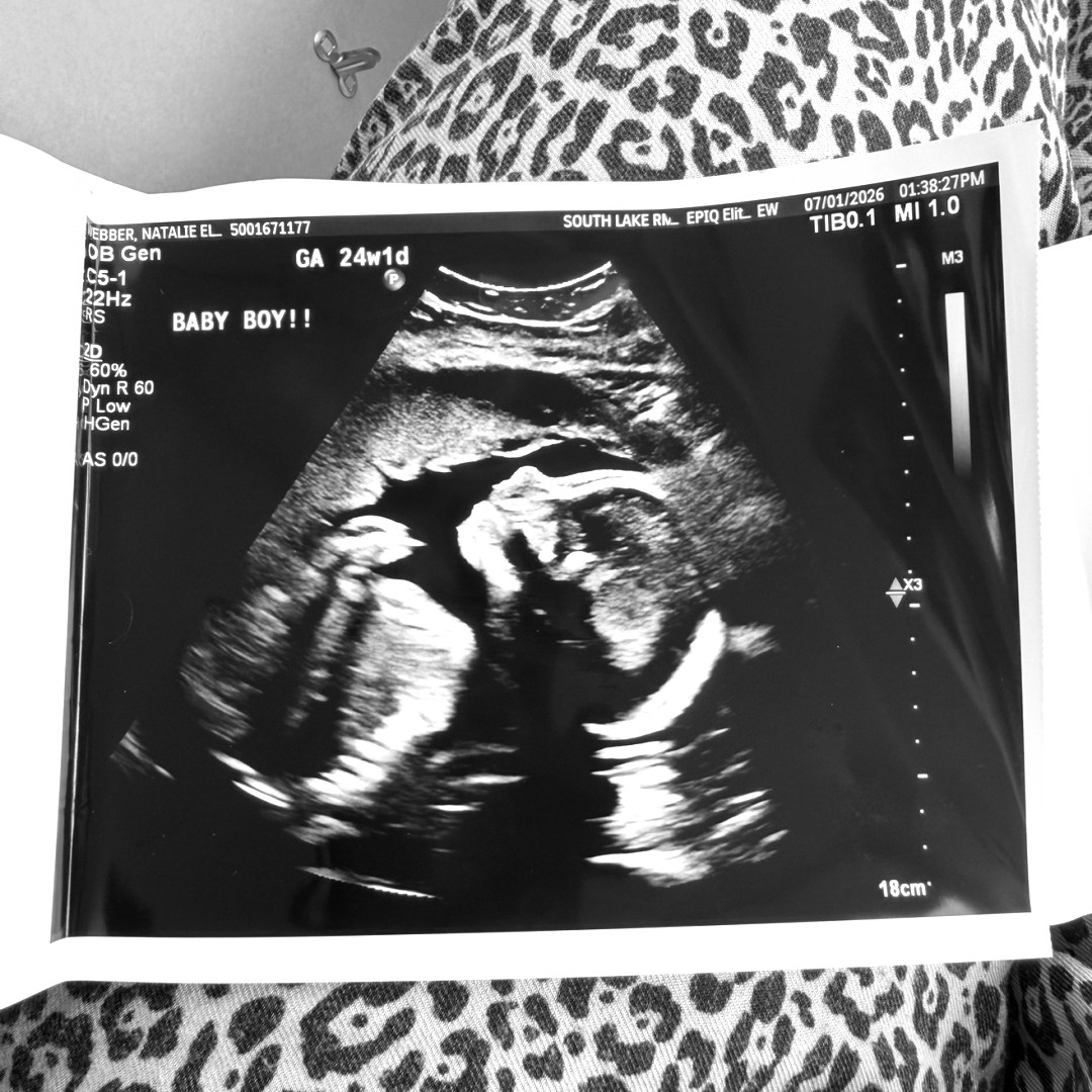 Photo shared by Natalie for their Babylist baby registry.
