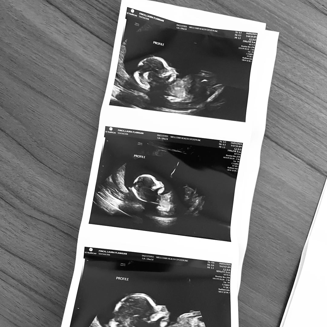 Photo shared by Laura for their Babylist baby registry.
