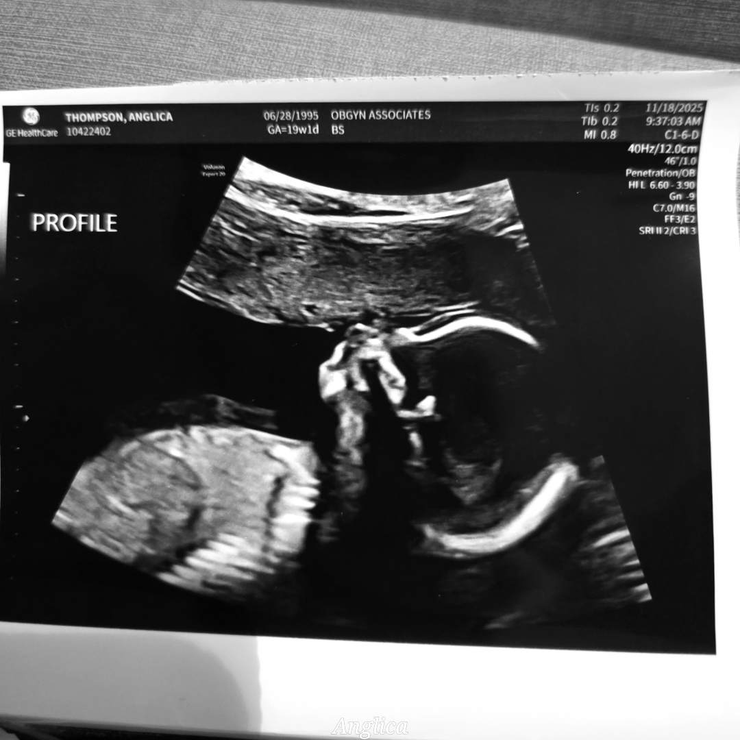 Photo shared by Anglica for their Babylist baby registry.