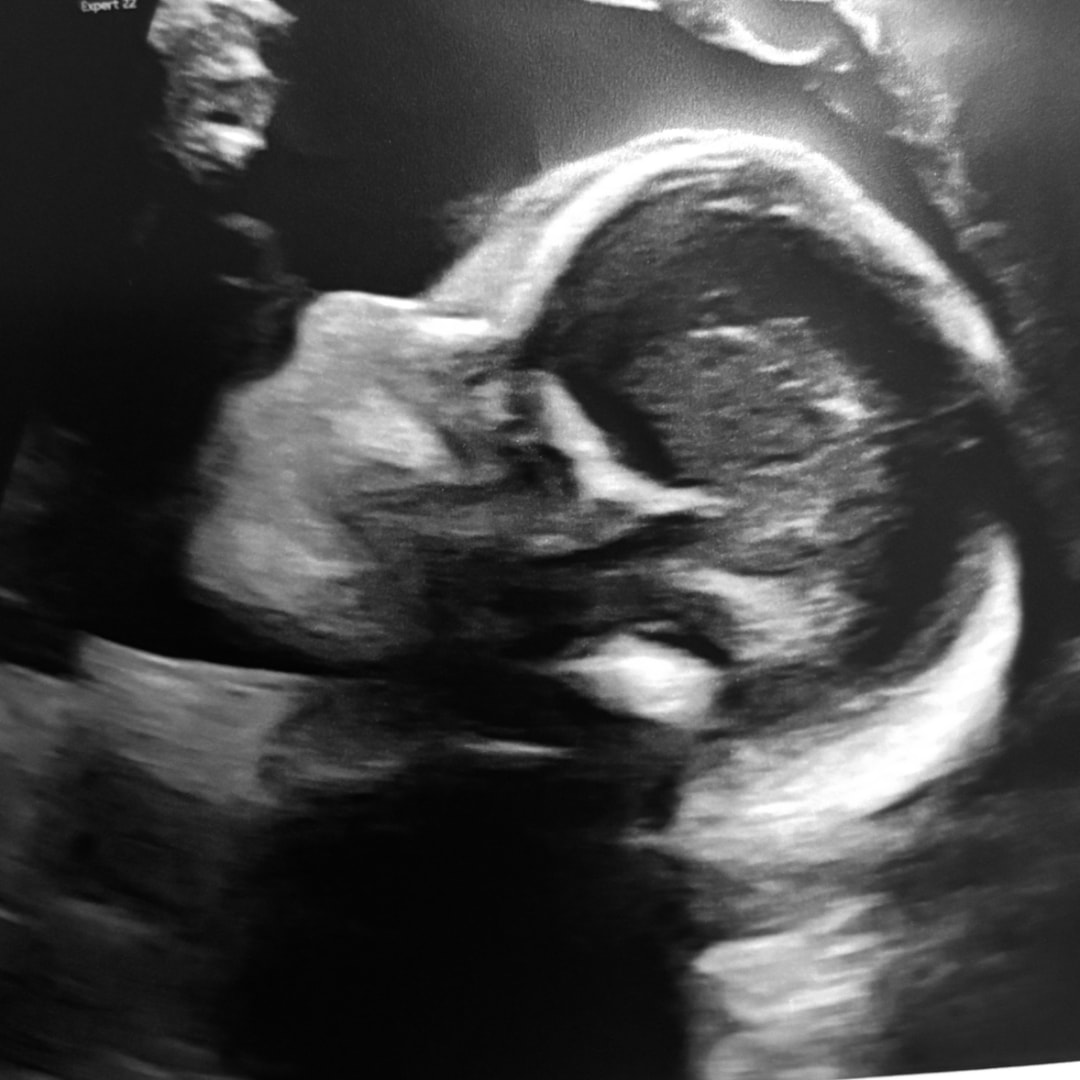 Photo shared by Megan for their Babylist baby registry.