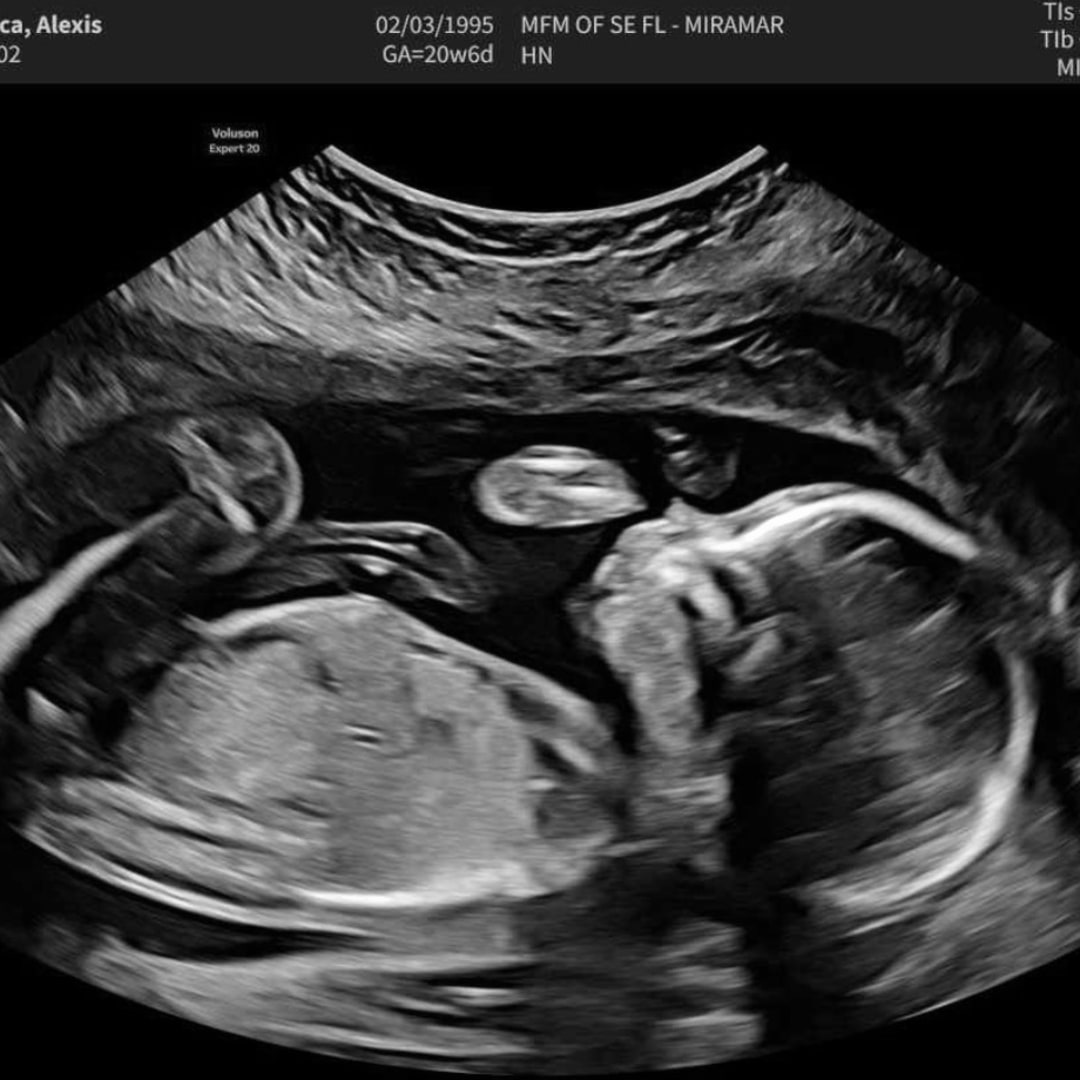 Photo shared by Lexi for their Babylist baby registry.