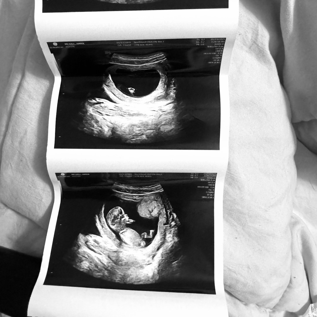 Photo shared by Mya for their Babylist baby registry.