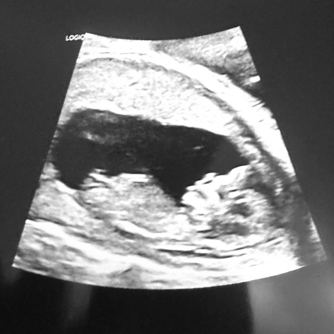 Photo shared by Mattison for their Babylist baby registry.