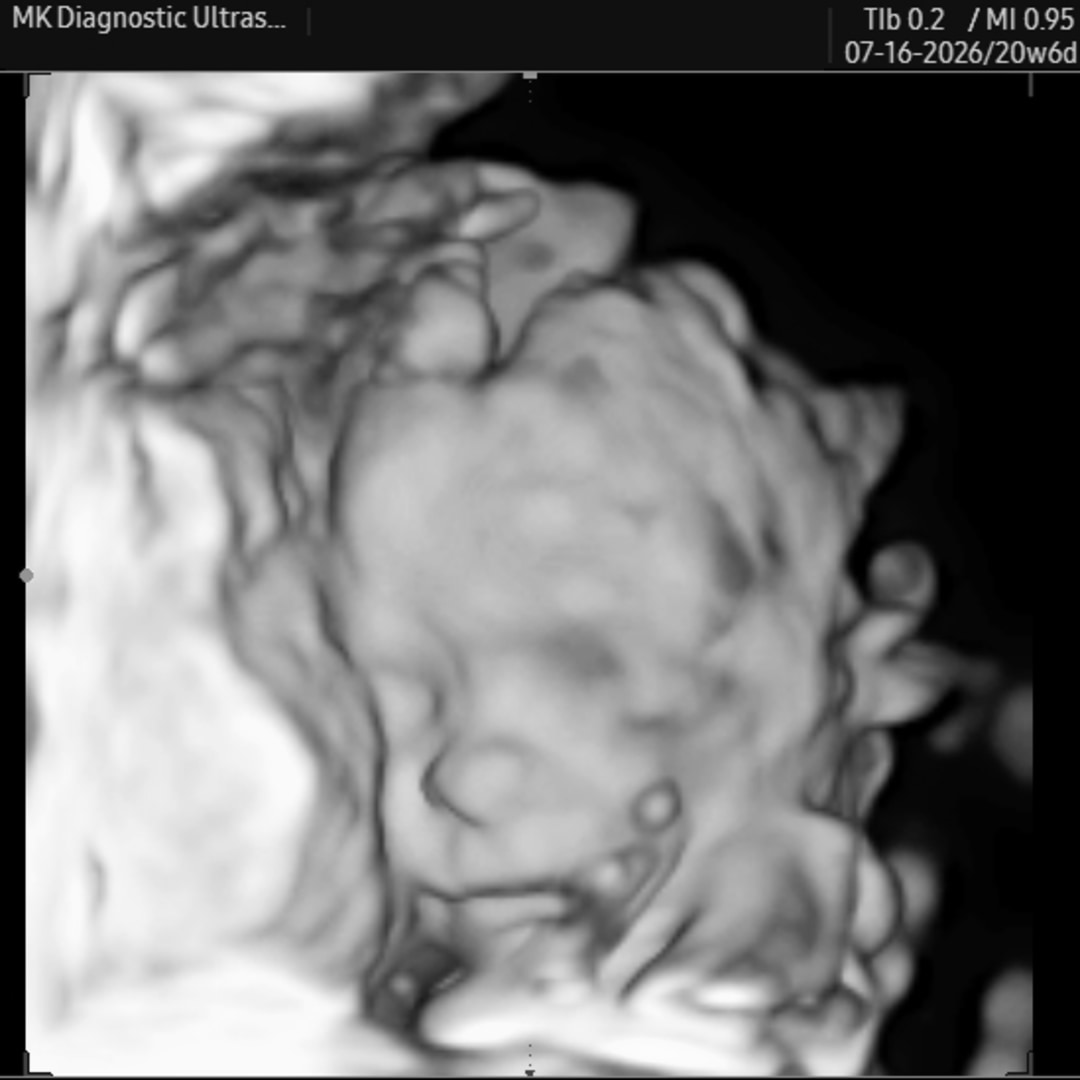 Photo shared by Katie for their Babylist baby registry.