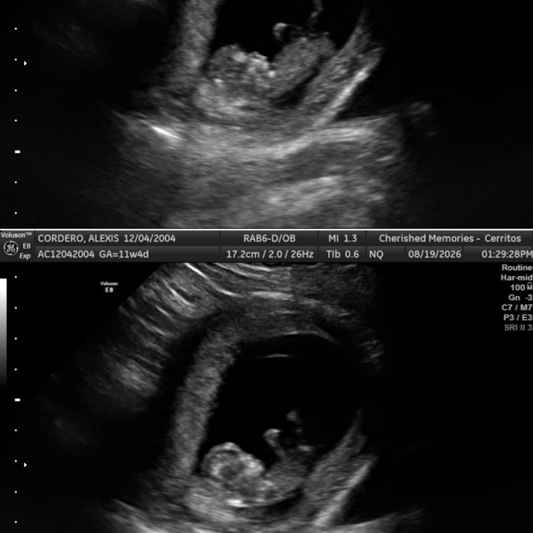 Photo shared by Alexis for their Babylist baby registry.