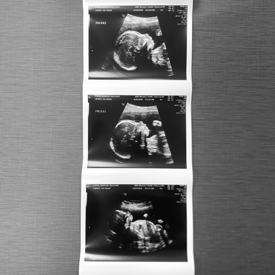 Photo shared by Madison for their Babylist baby registry.