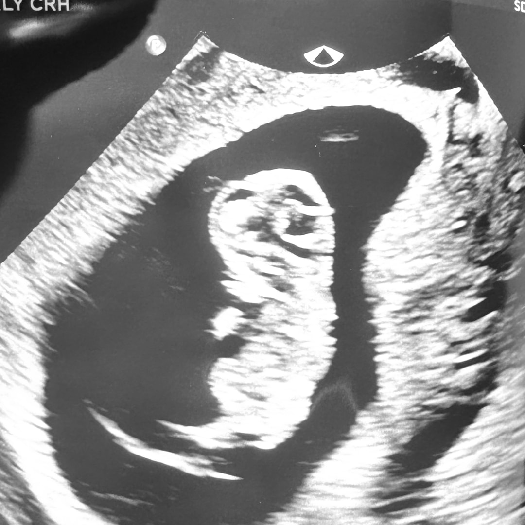 Photo shared by Katie for their Babylist baby registry.
