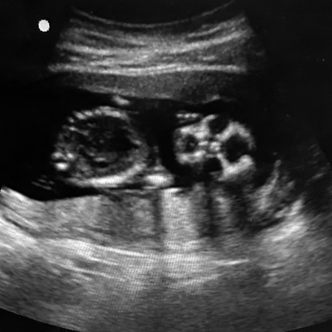 Photo shared by Angela for their Babylist baby registry.