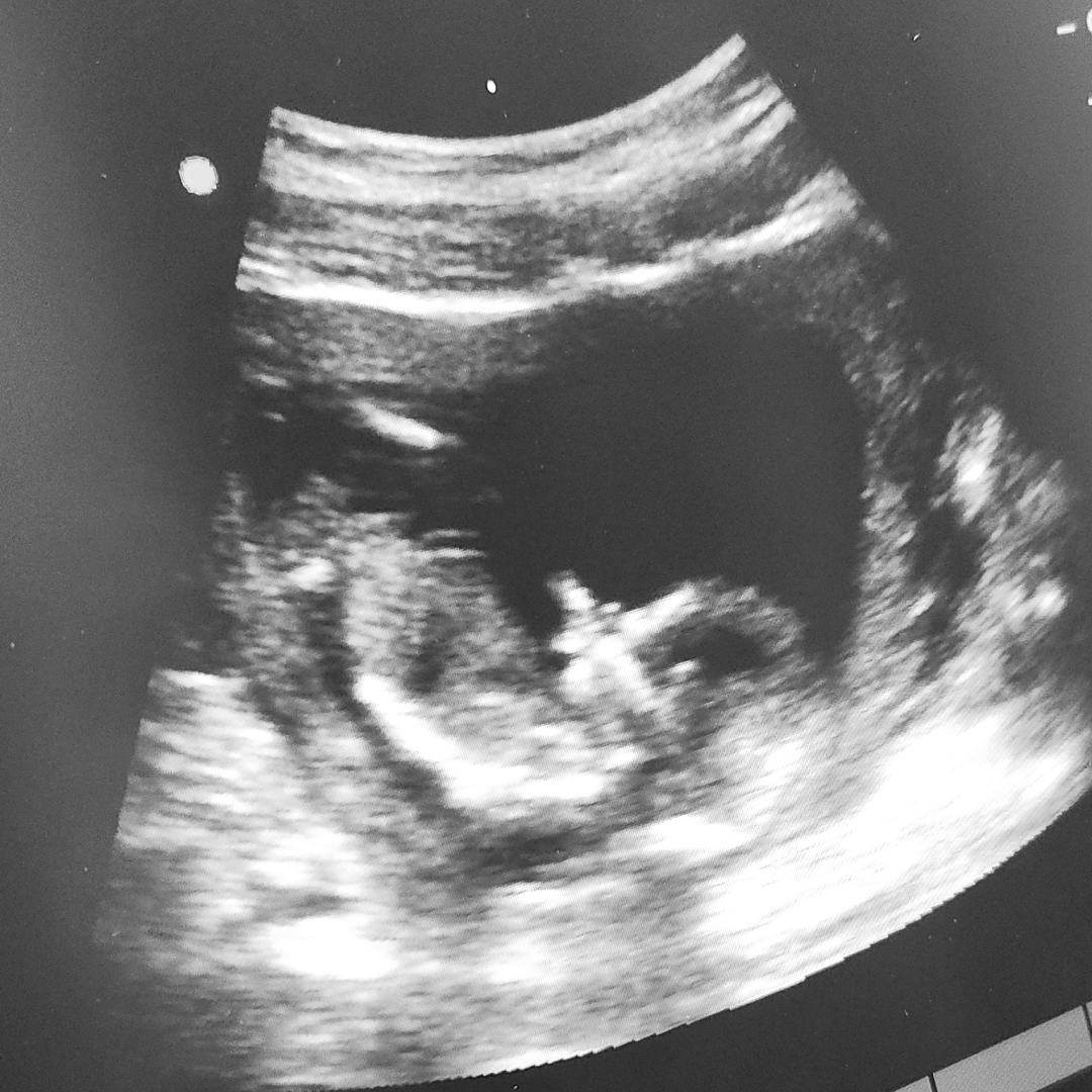 Photo shared by Michelle for their Babylist baby registry.