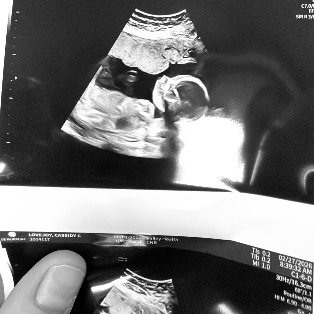 Photo shared by Cassidy for their Babylist baby registry.