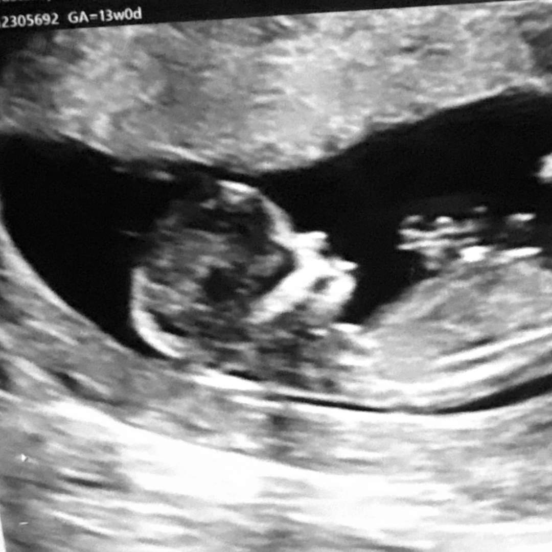 Photo shared by Ashley for their Babylist baby registry.