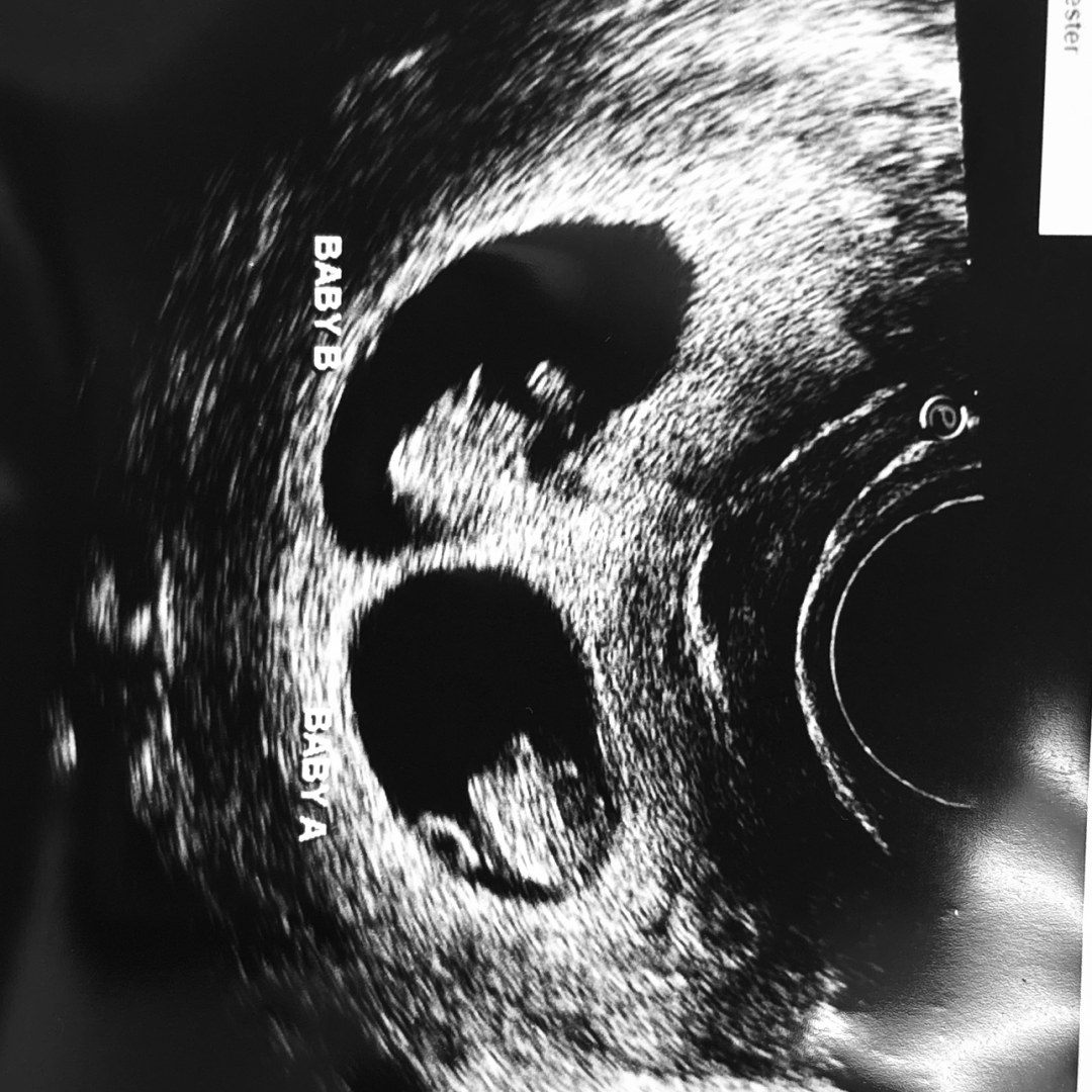 Photo shared by Chloe for their Babylist baby registry.