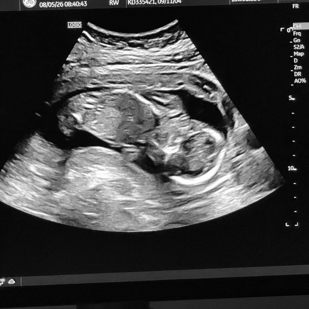 Photo shared by Kylee for their Babylist baby registry.