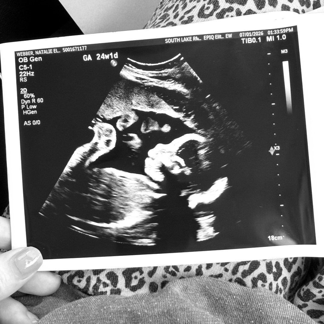 Photo shared by Natalie for their Babylist baby registry.