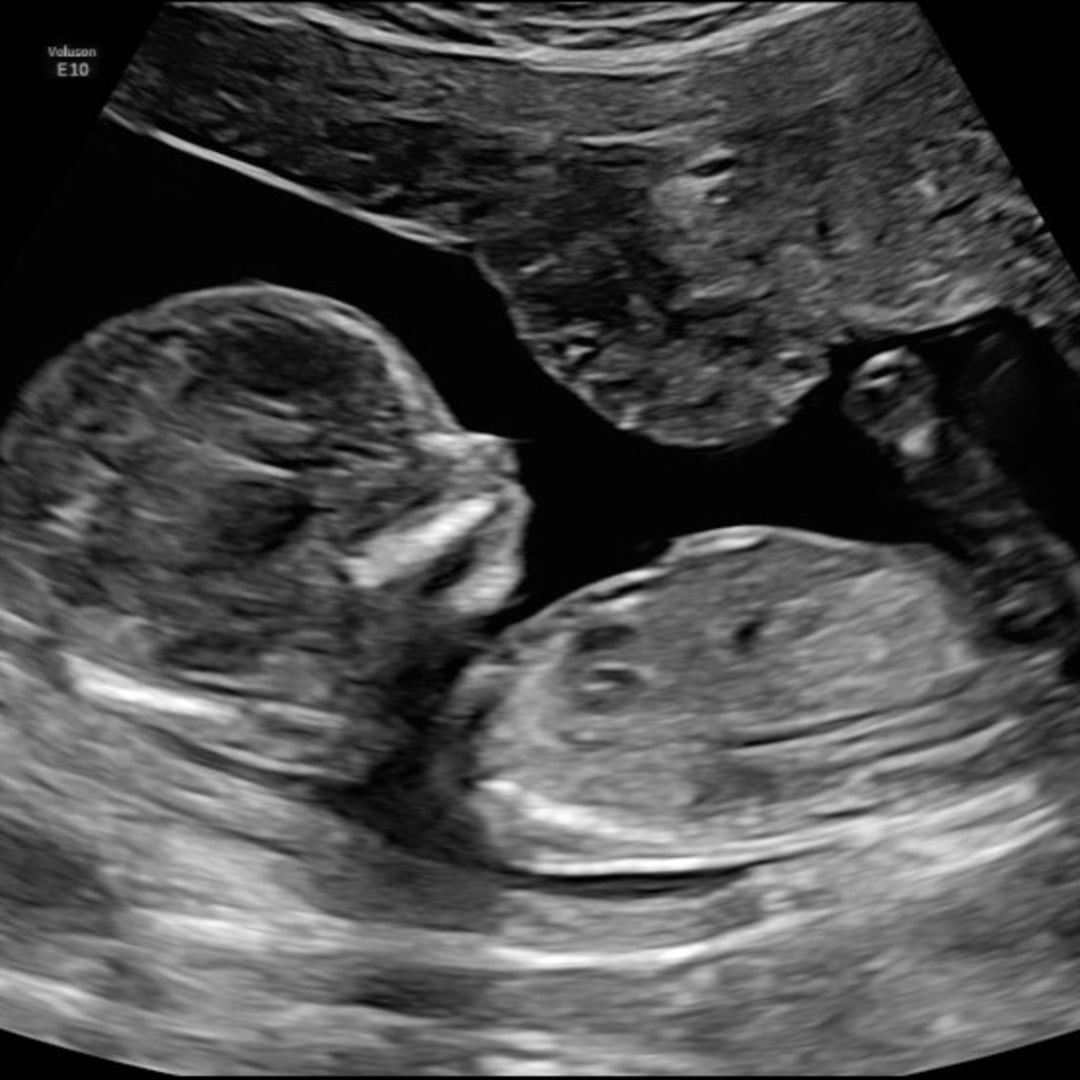 Photo shared by Clarissa for their Babylist baby registry.