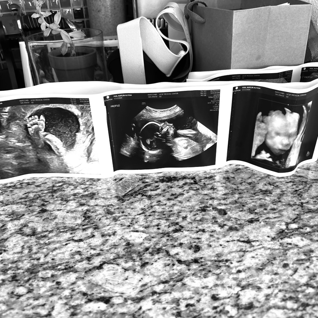 Photo shared by Kaylin for their Babylist baby registry.