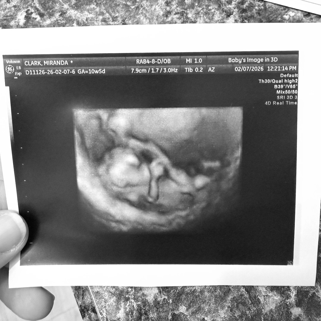 Photo shared by Miranda for their Babylist baby registry.
