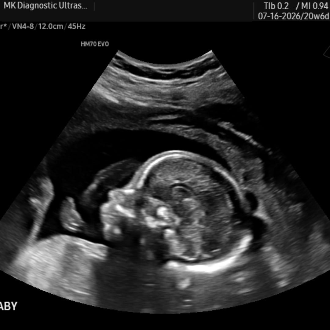 Photo shared by Katie for their Babylist baby registry.