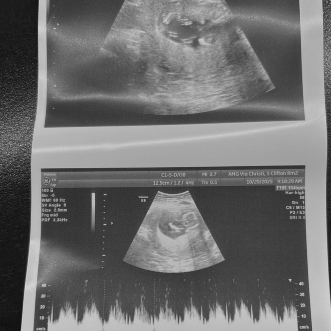 Photo shared by Erykah for their Babylist baby registry.