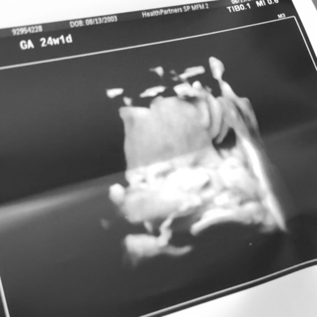 Photo shared by Cambree for their Babylist baby registry.