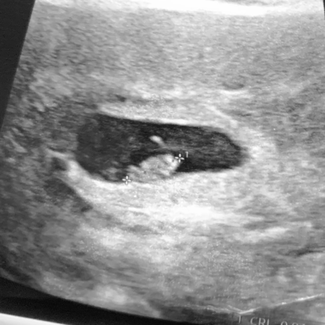 Photo shared by Darla for their Babylist baby registry.
