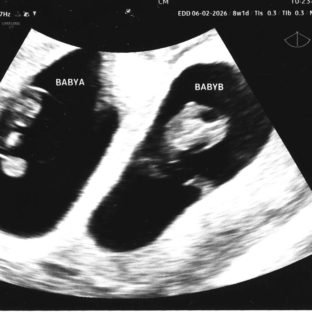 Photo shared by Tia for their Babylist baby registry.