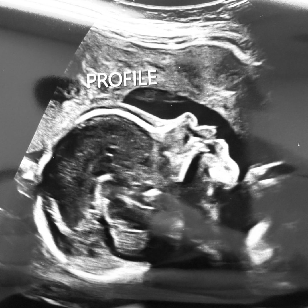 Photo shared by Karen for their Babylist baby registry.