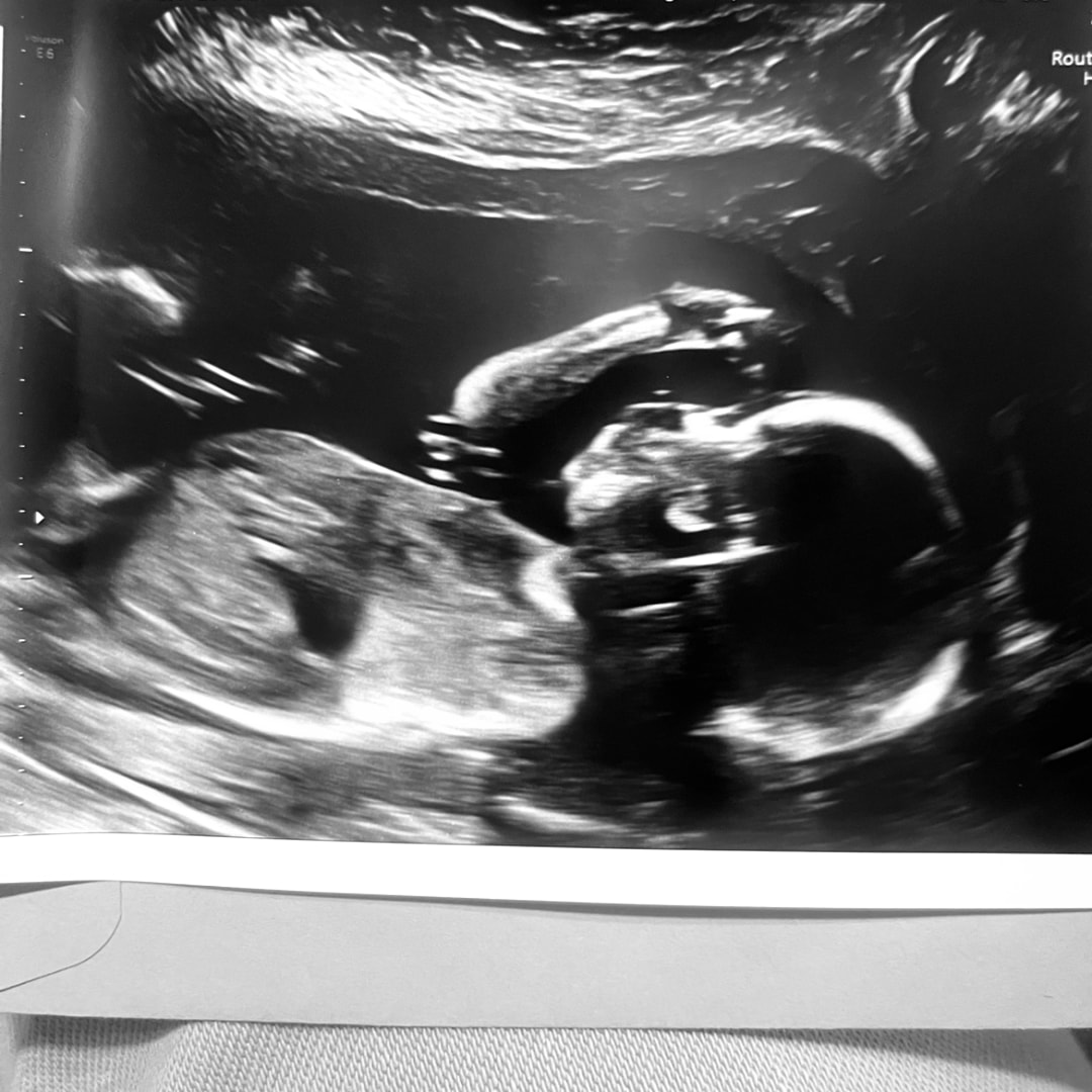 Photo shared by Lauren for their Babylist baby registry.