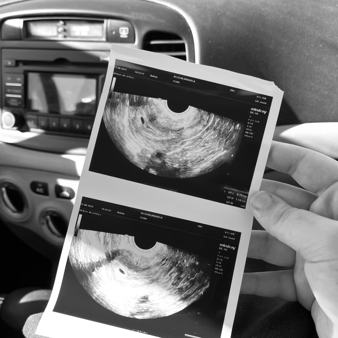 Photo shared by Klayton for their Babylist baby registry.