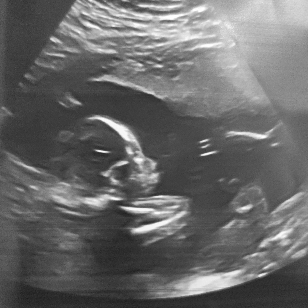 Photo shared by Carlie for their Babylist baby registry.