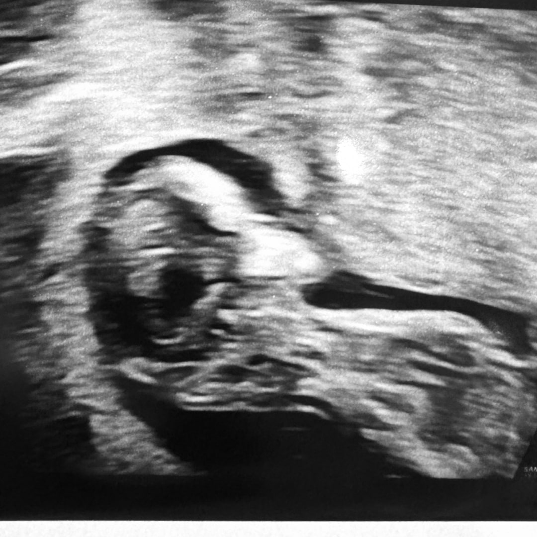 Photo shared by Julia for their Babylist baby registry.